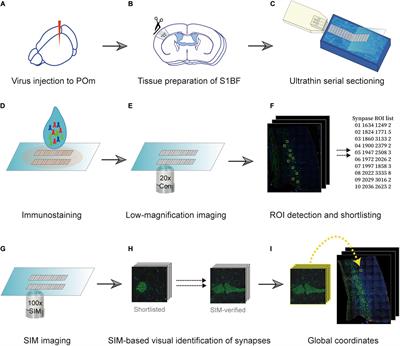 Efficient and Accurate Synapse Detection With Selective Structured Illumination Microscopy on the Putative Regions of Interest of Ultrathin Serial Sections